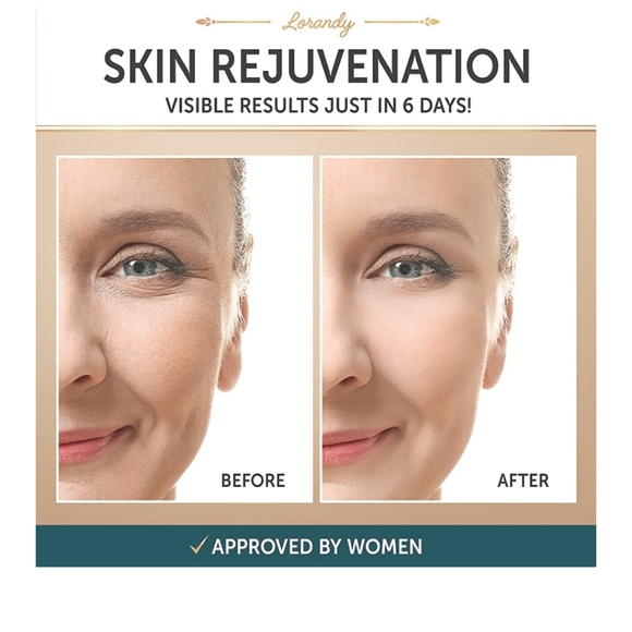 lorandy collagen cream